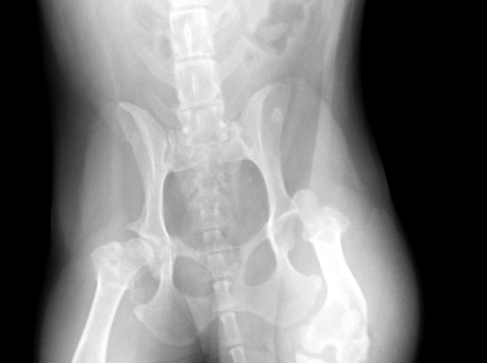 レントゲン写真1