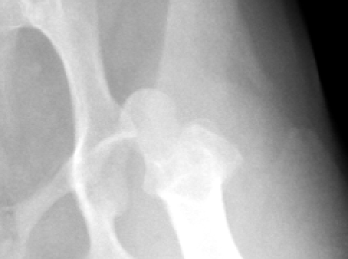 レントゲン写真2