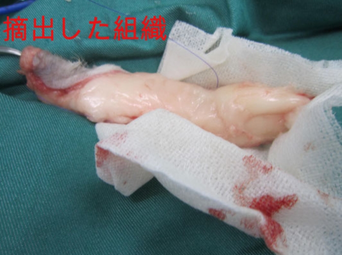 摘出した組織